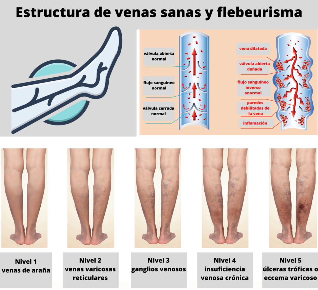 Qué hacer si duelen los músculos de las piernas? - Centro Quiropráctico y de Quiromasaje Barcelona. | Lorem Masaje & Bienestar